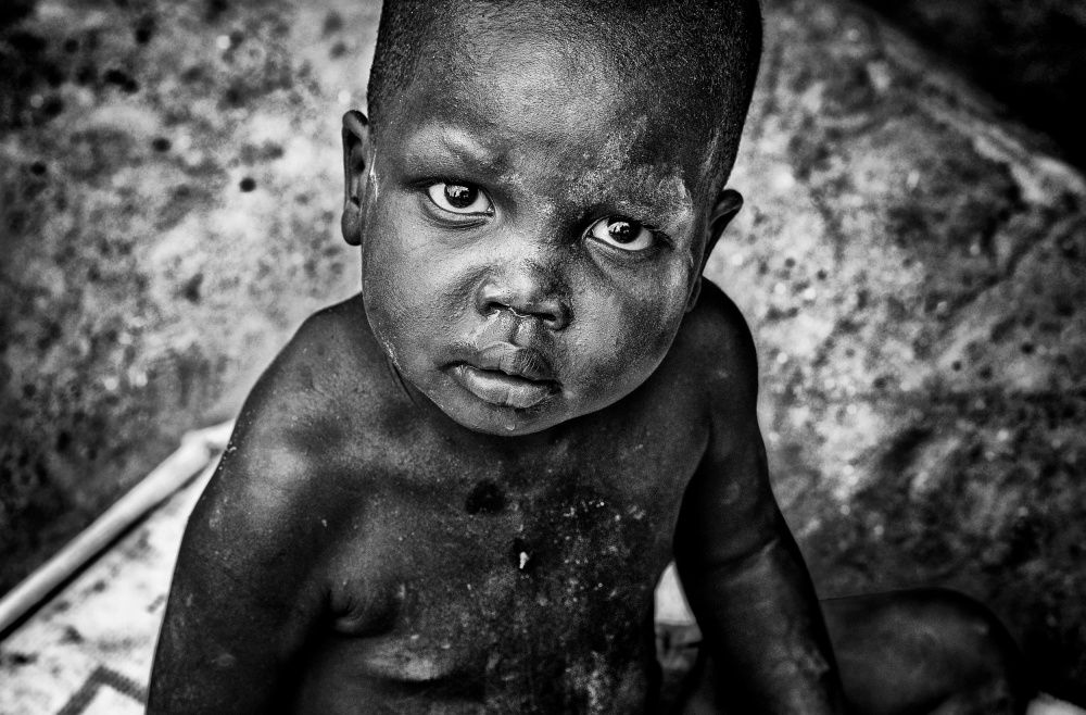 Child from South Sudan from Joxe Inazio Kuesta Garmendia